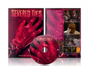 Severed Ties