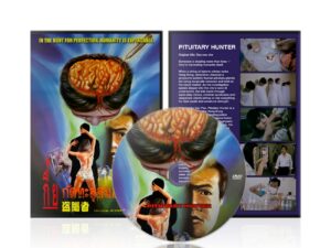 PITUITARY HUNTER